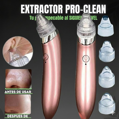 Extractor de espinillas y puntos negros